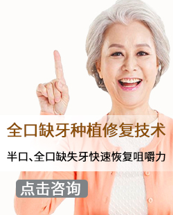 全口种植